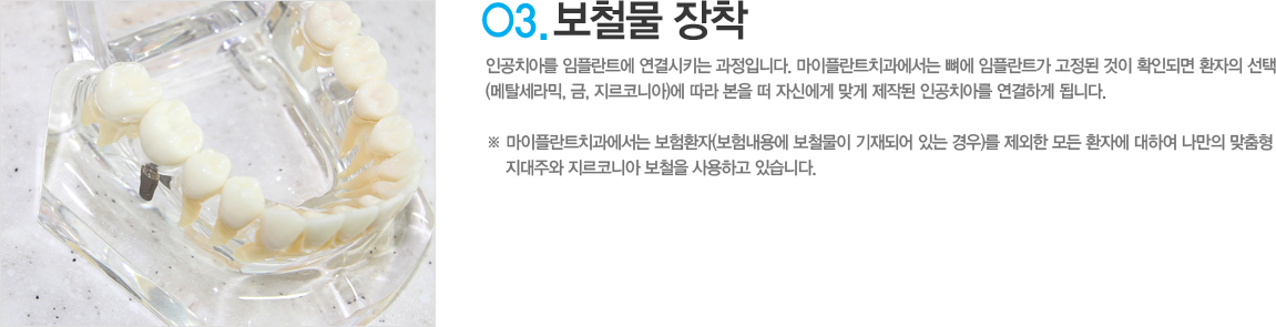 3. ö 
 ΰġƸ öƮ Ű Դϴ. öƮġ  öƮ   ȮεǸ ȯ (Ż, , ڴϾ)    ڽſ ° ۵ ΰġƸ ϰ ˴ϴ.
*ƲƮġ ȯ(賻뿡 ö Ǿ ִ )  ȯڵ     ڴϾƸ ϰ ֽϴ.
